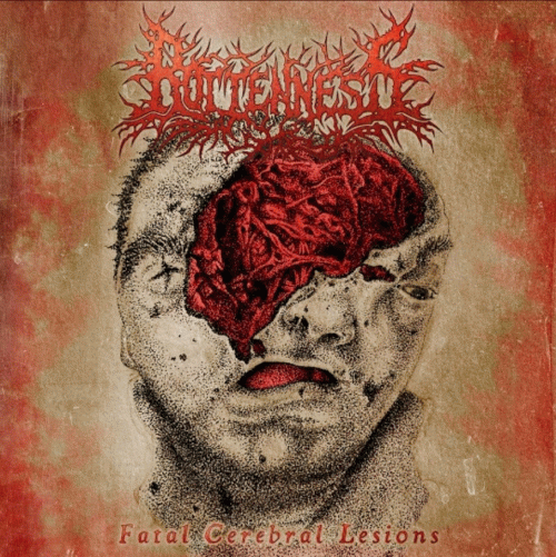 Rottenness : Fatal Cerebral Lesions